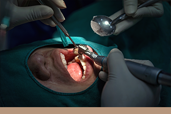 BClinic - Dental Clinic - Services - Corrective Jaw Surgeries