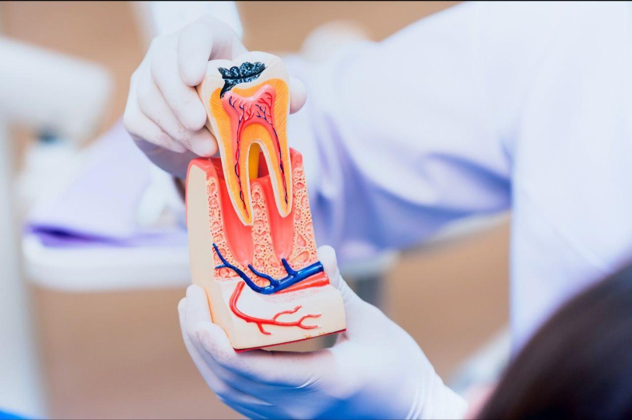 BClinic - Dental Clinic - Services - Endodontics
