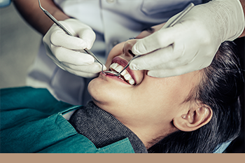 BClinic - Dental Clinic - Services - Dental Sealants
